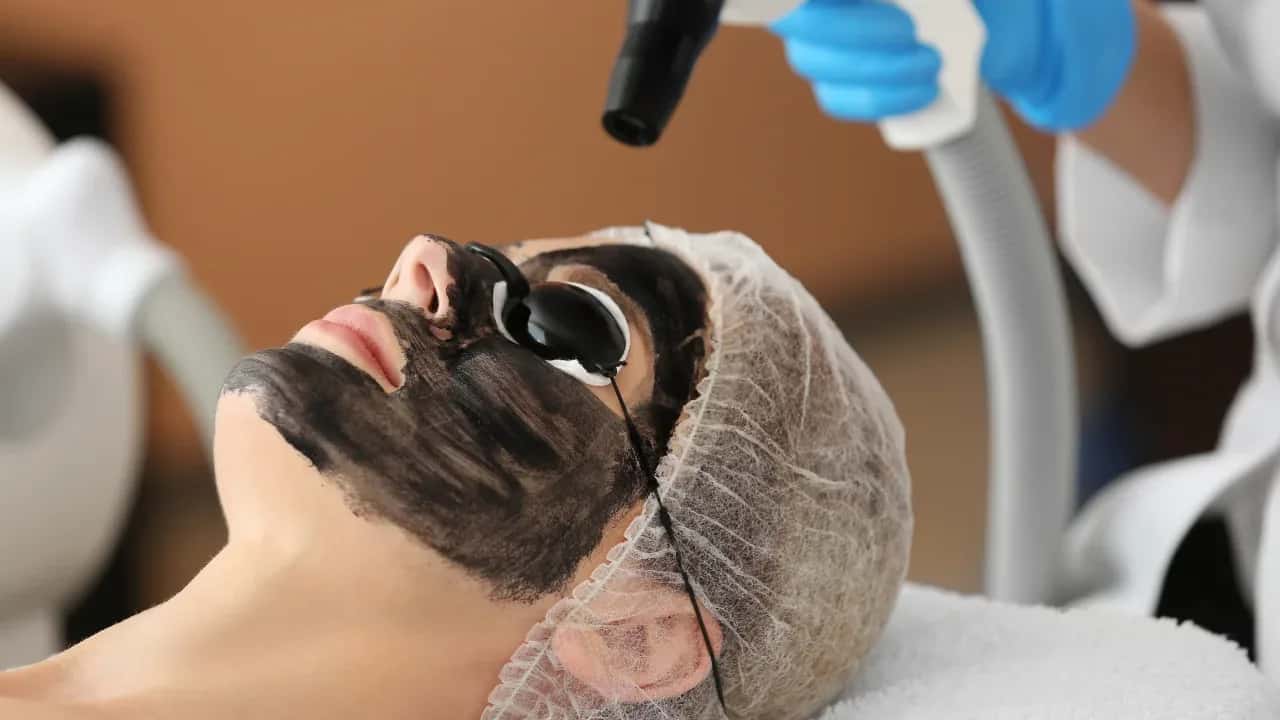 Aftercare Tips for Carbon Peeling Success