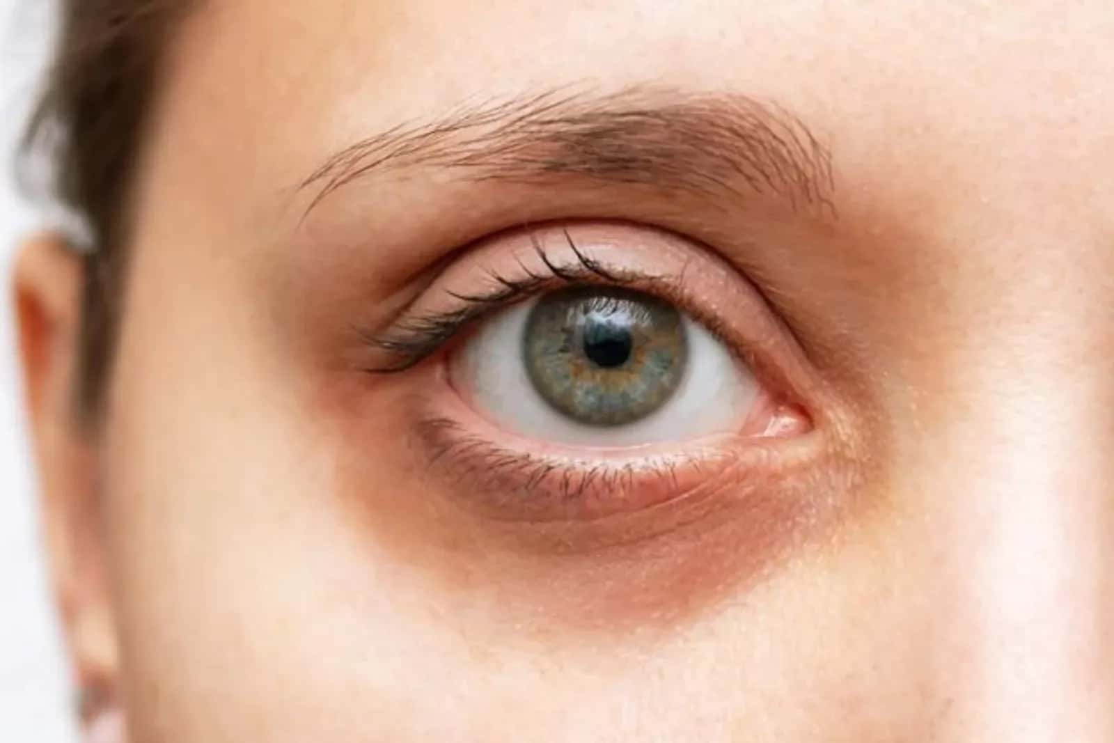 Best Skincare Products for Dark Circles