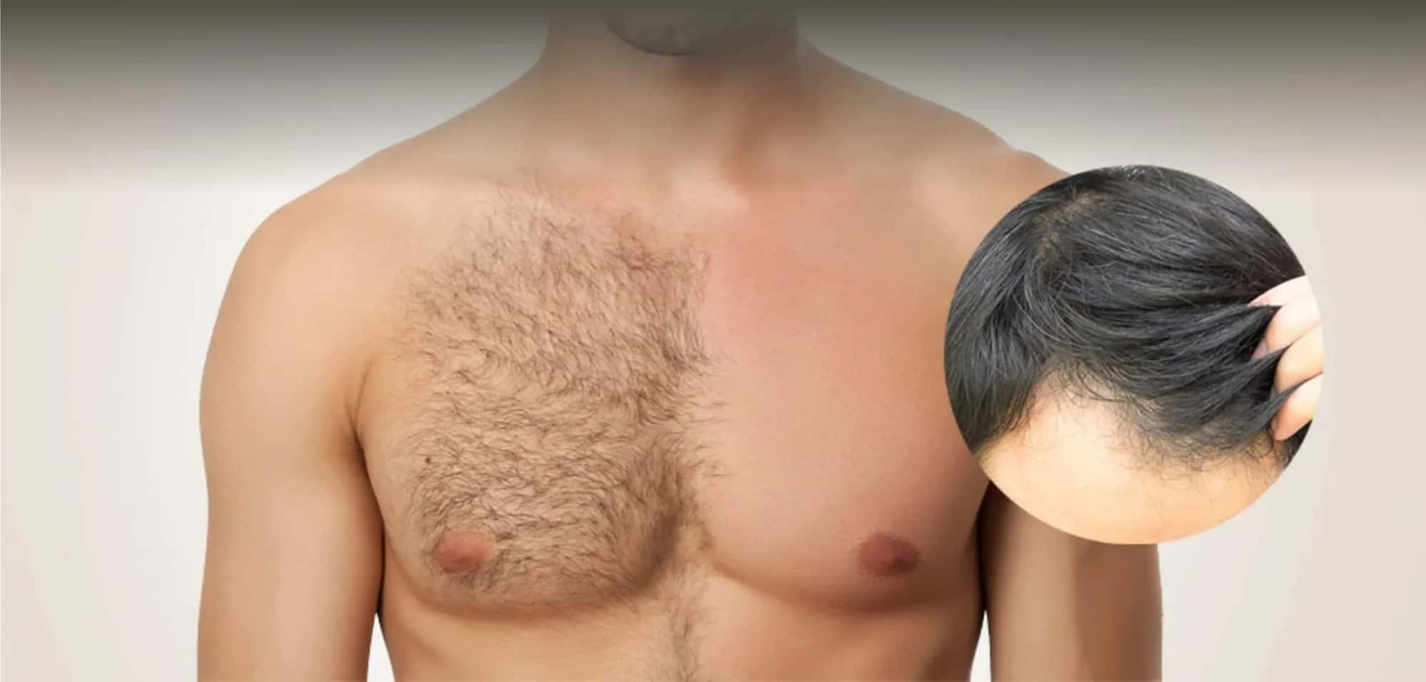 Body Hair Transplant BHT Costs Around the World: 2026 Country-by-Country Guide