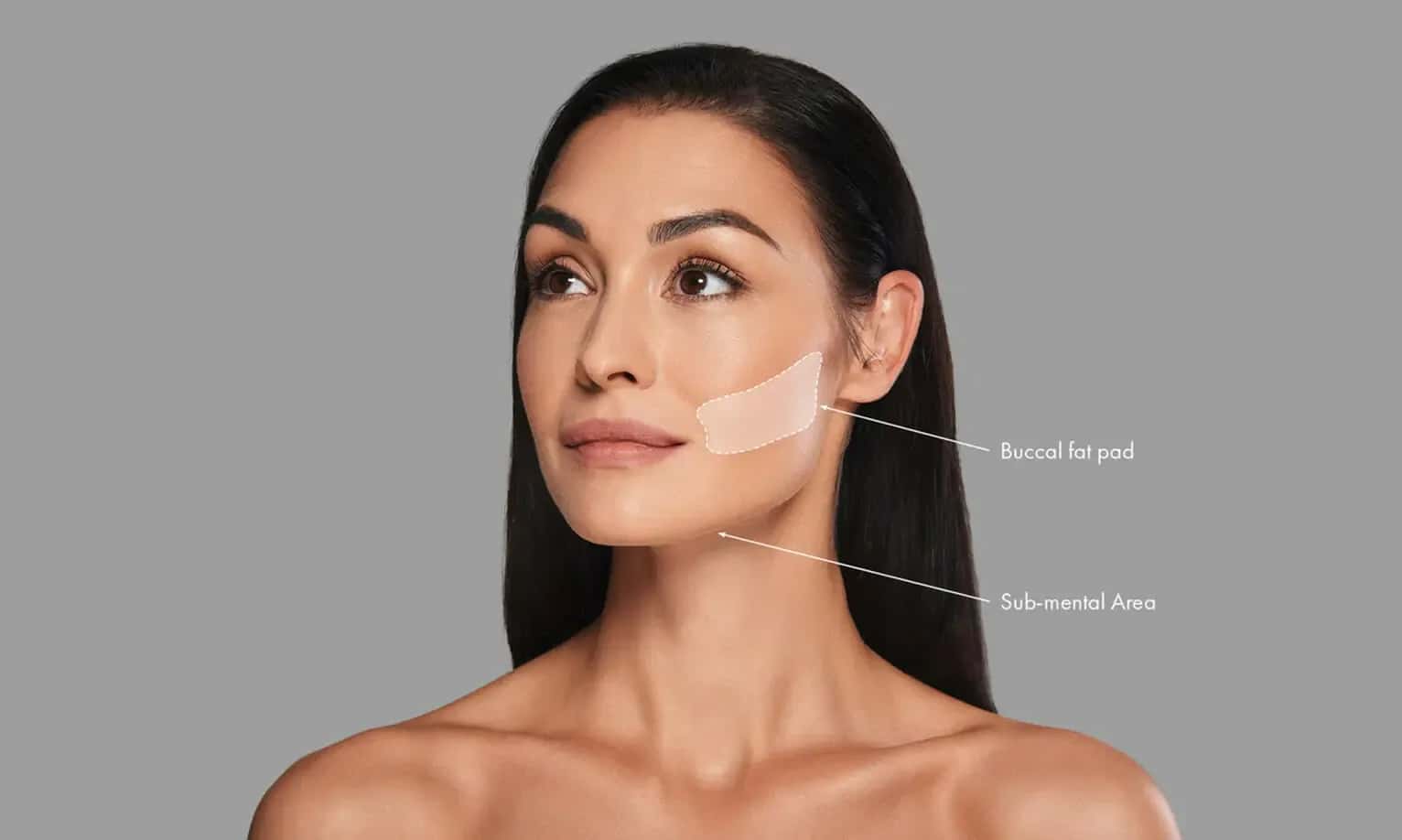 Buccal Fat Removal Costs Around the World: 2026 Country-by-Country Guide