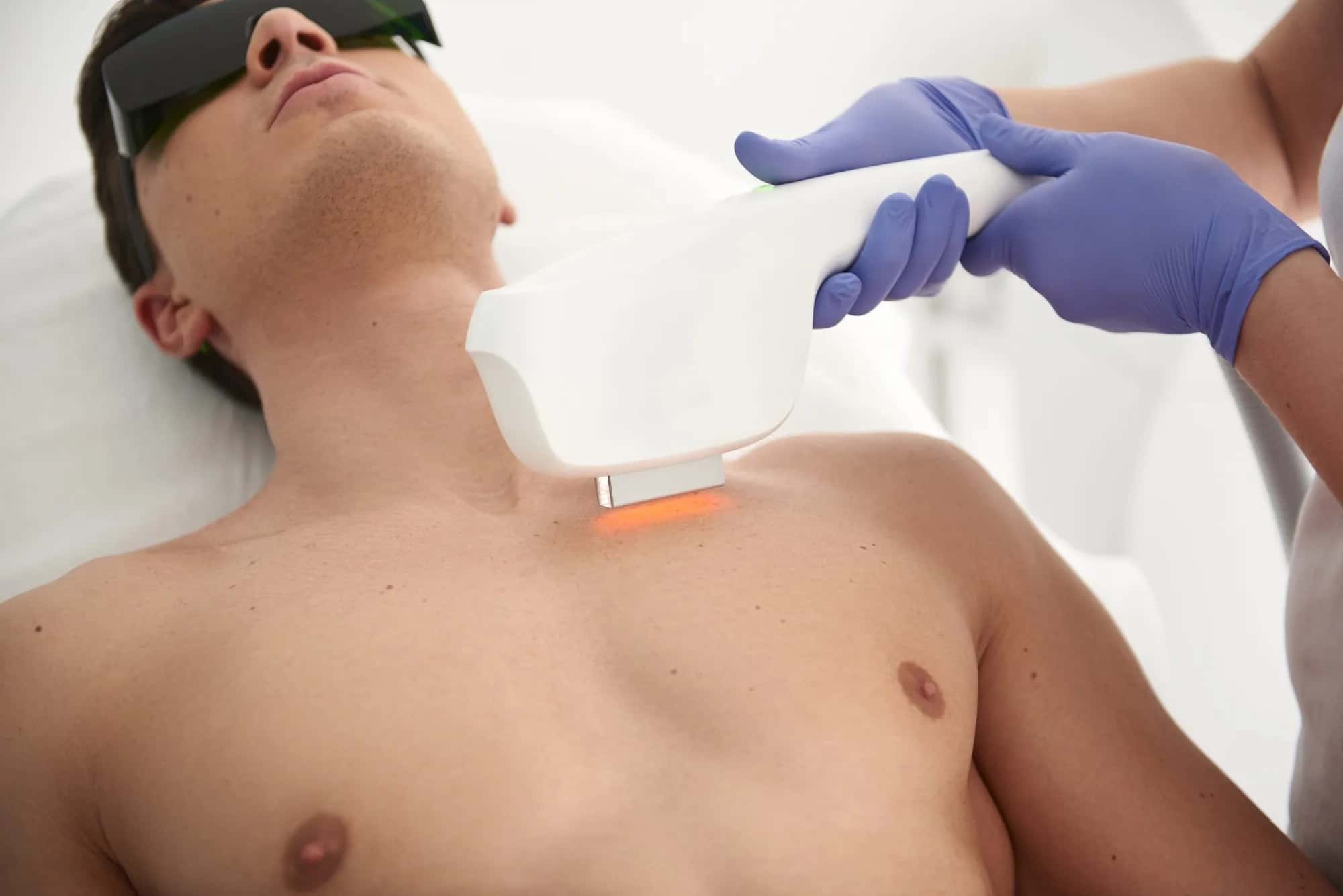 Can Laser Hair Removal Be Done Twice a Month?