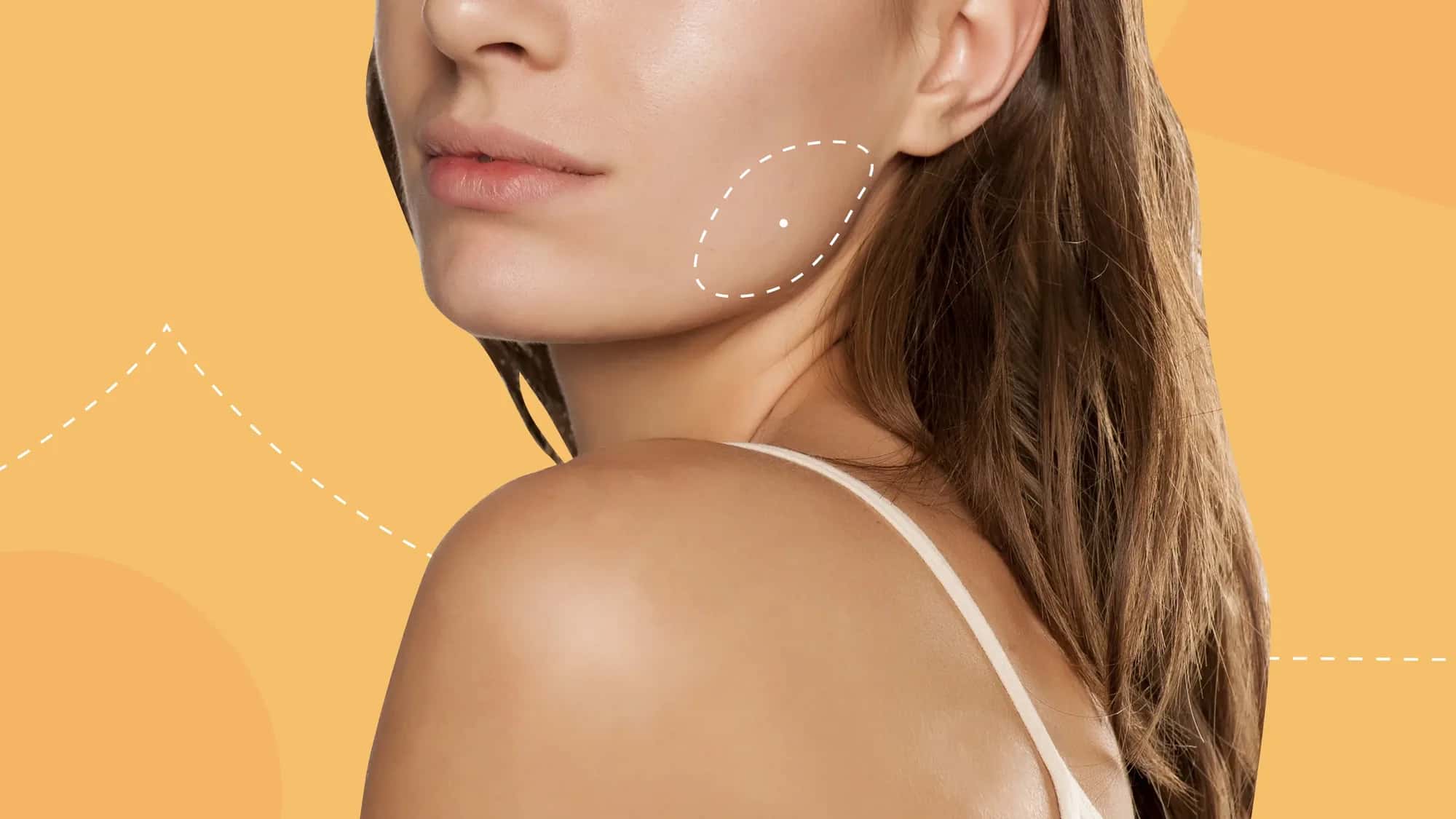 Çene İnceltme İçin Masseter Botoksu
