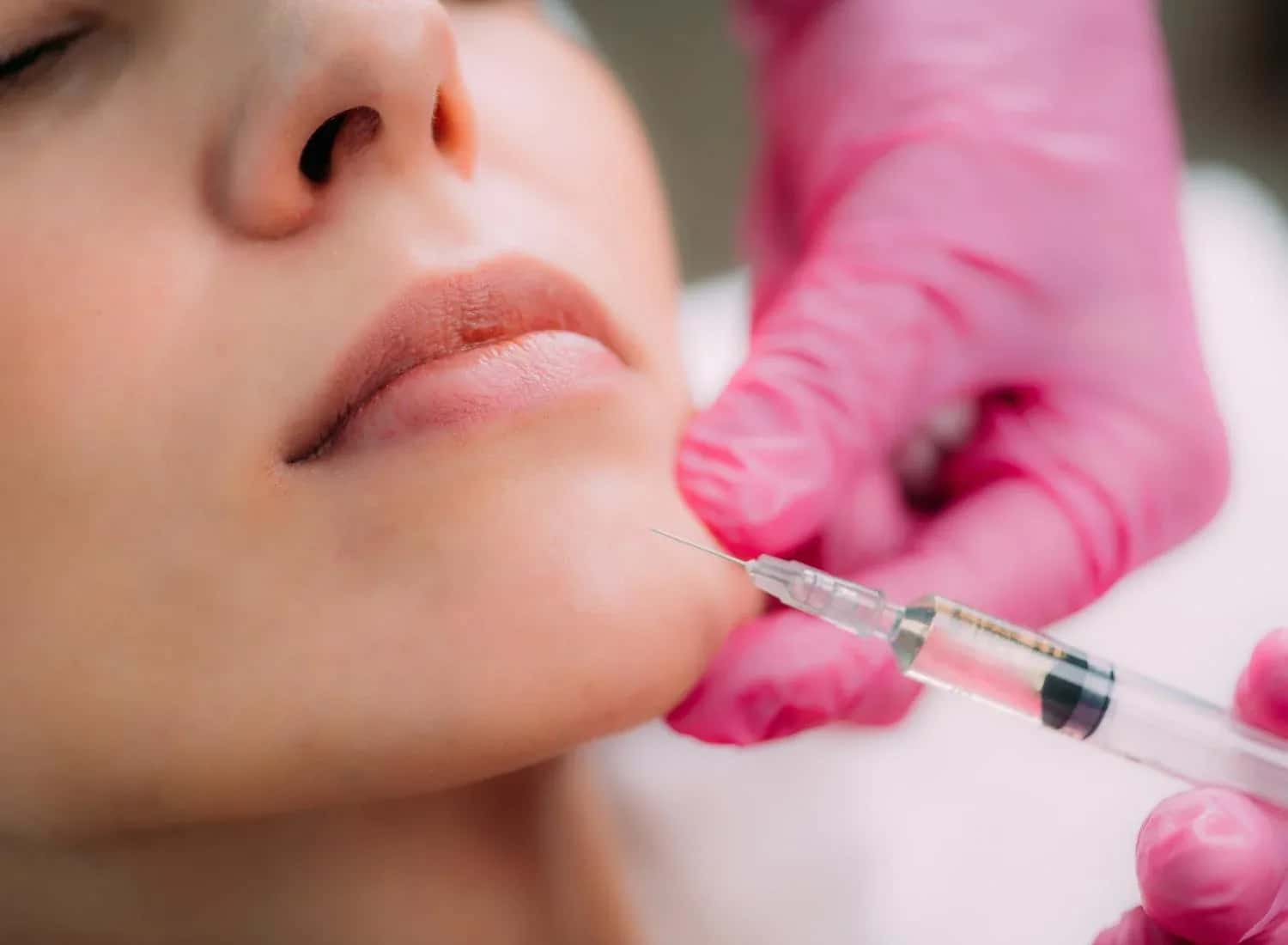 Chin Tip Filling: What to Expect