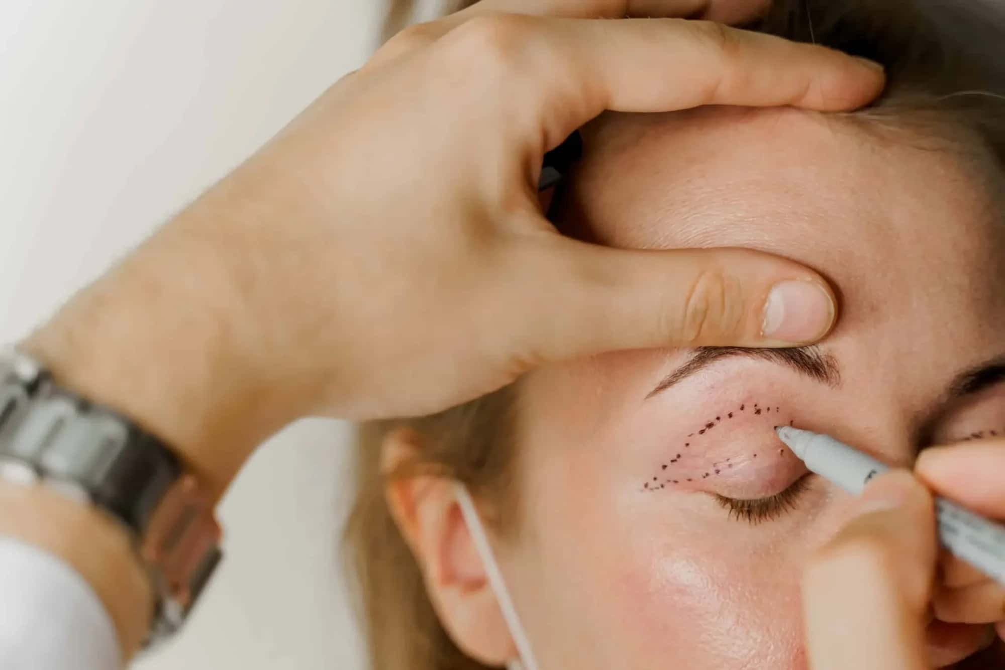 Coût de la blépharoplastie dans le monde : guide 2026 pays par pays
