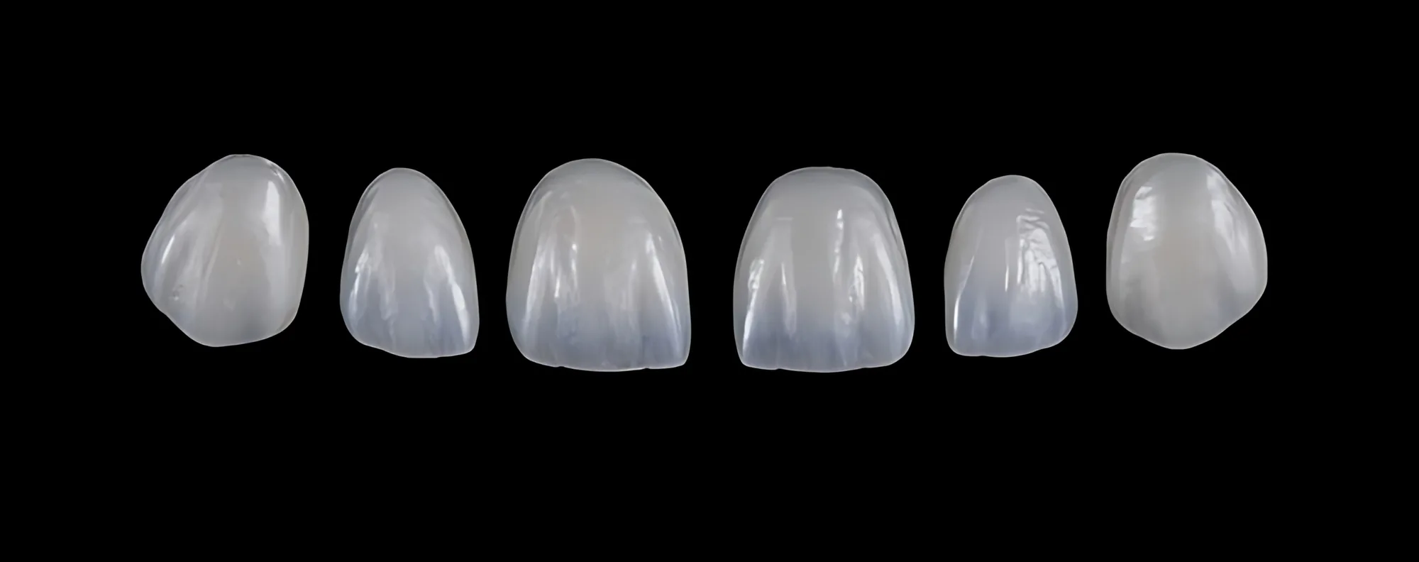 Crown Veneers Costs Around the World
