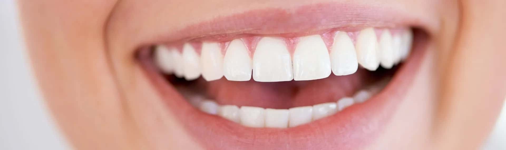 Full Mouth Reconstruction Abroad