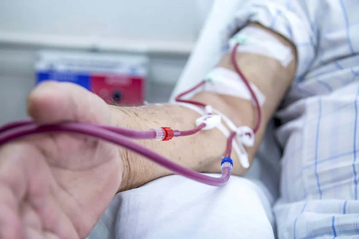 Going from Dialysis to Kidney Transplant