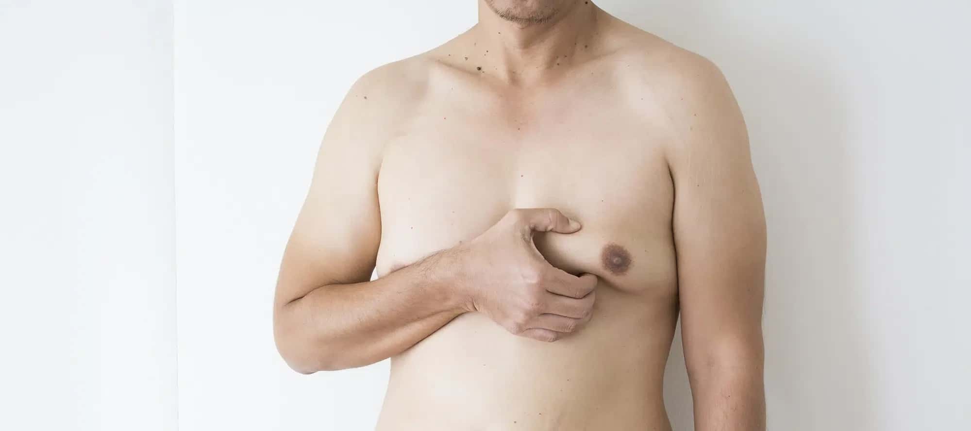 Gynecomastia Surgery Costs Around the World: 2026