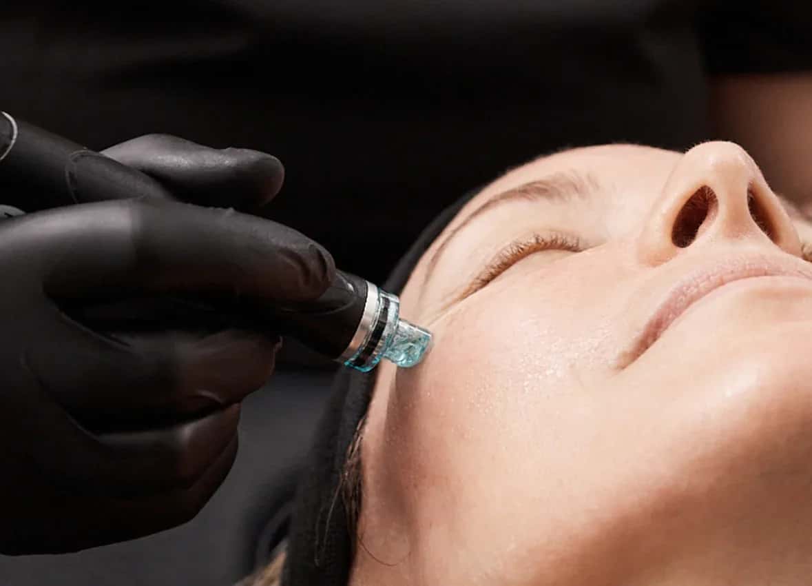 Hydrafacial Costs Around the World: 2026 Country-by-Country Guide