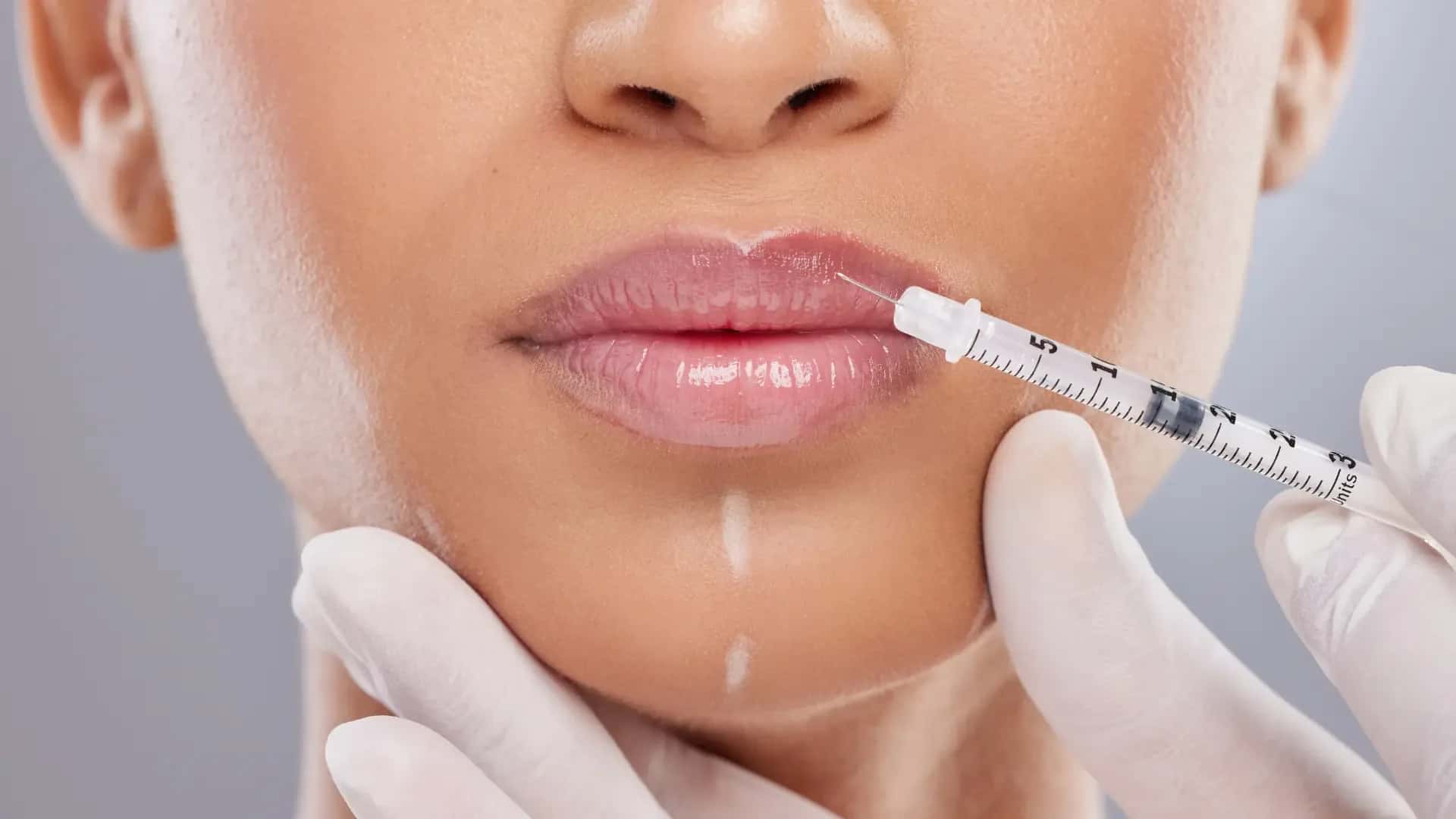 Lip Filler Costs Around the World