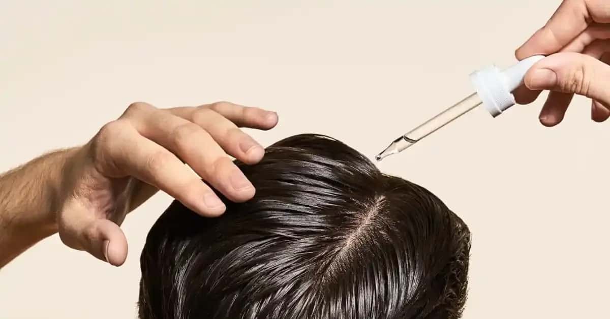 Procapil ou Minoxidil : lequel est le plus efficace ?