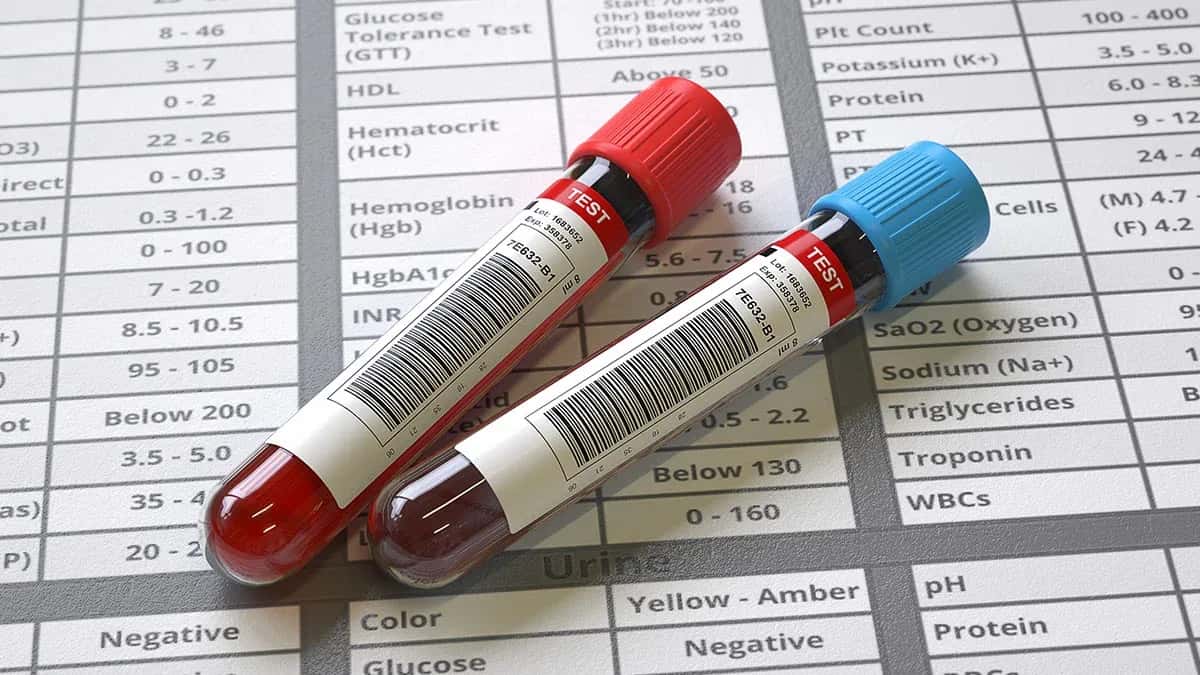 Top 3 Tests Used to Diagnose Primary Immunodeficiency