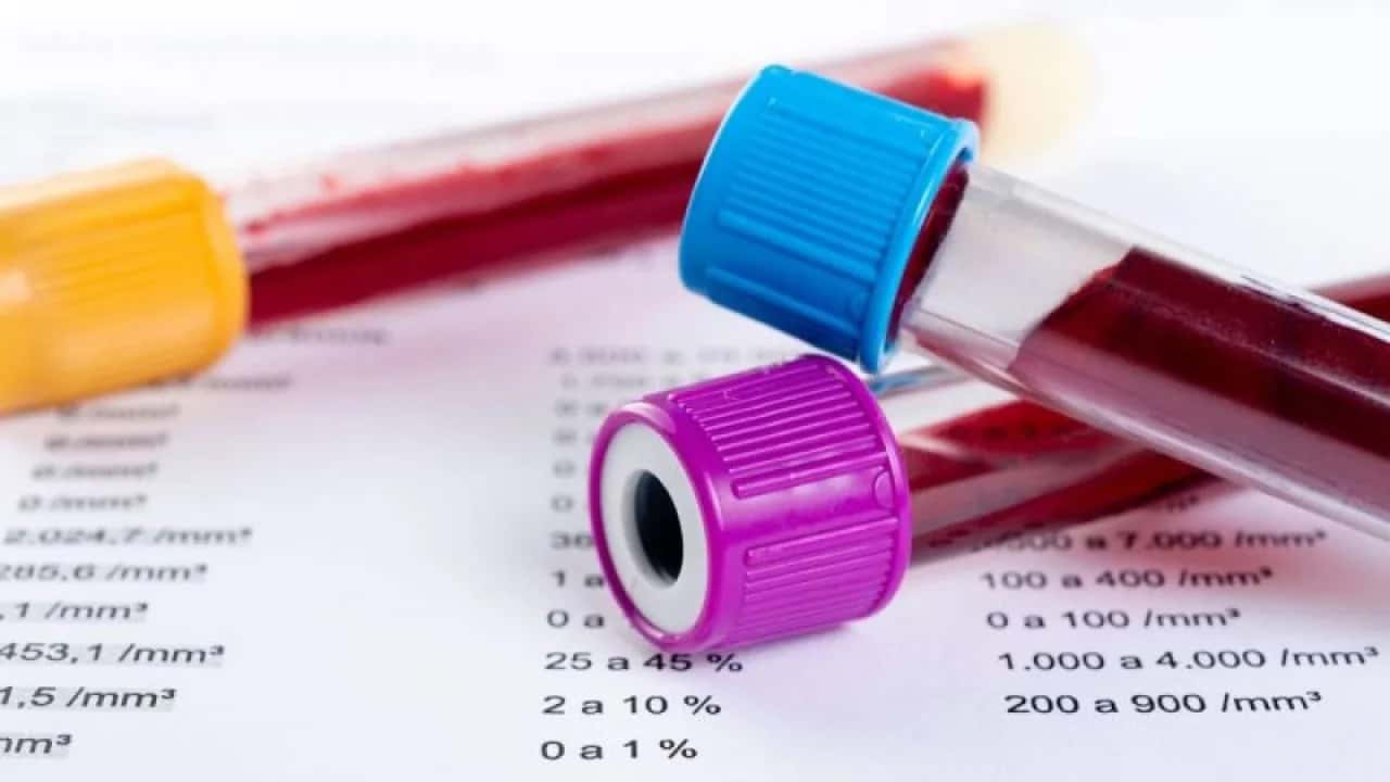 Understanding Cardiac Blood Tests: A Guide