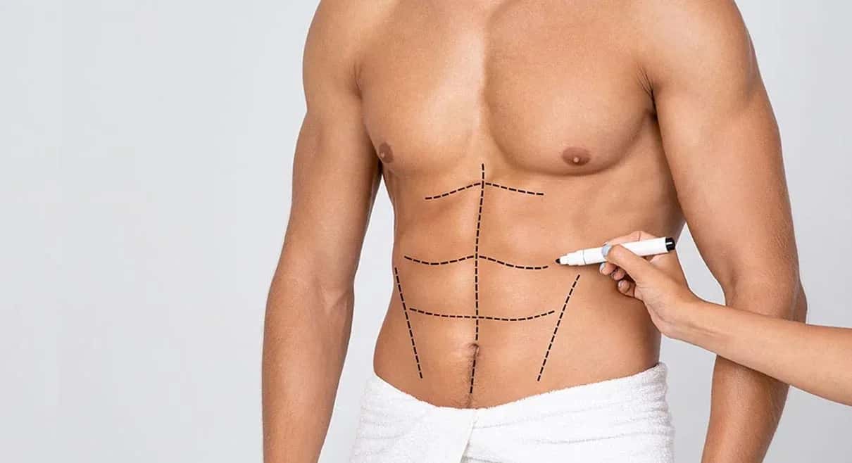 Vaser Liposuction: Procedure, Benefits, Recovery