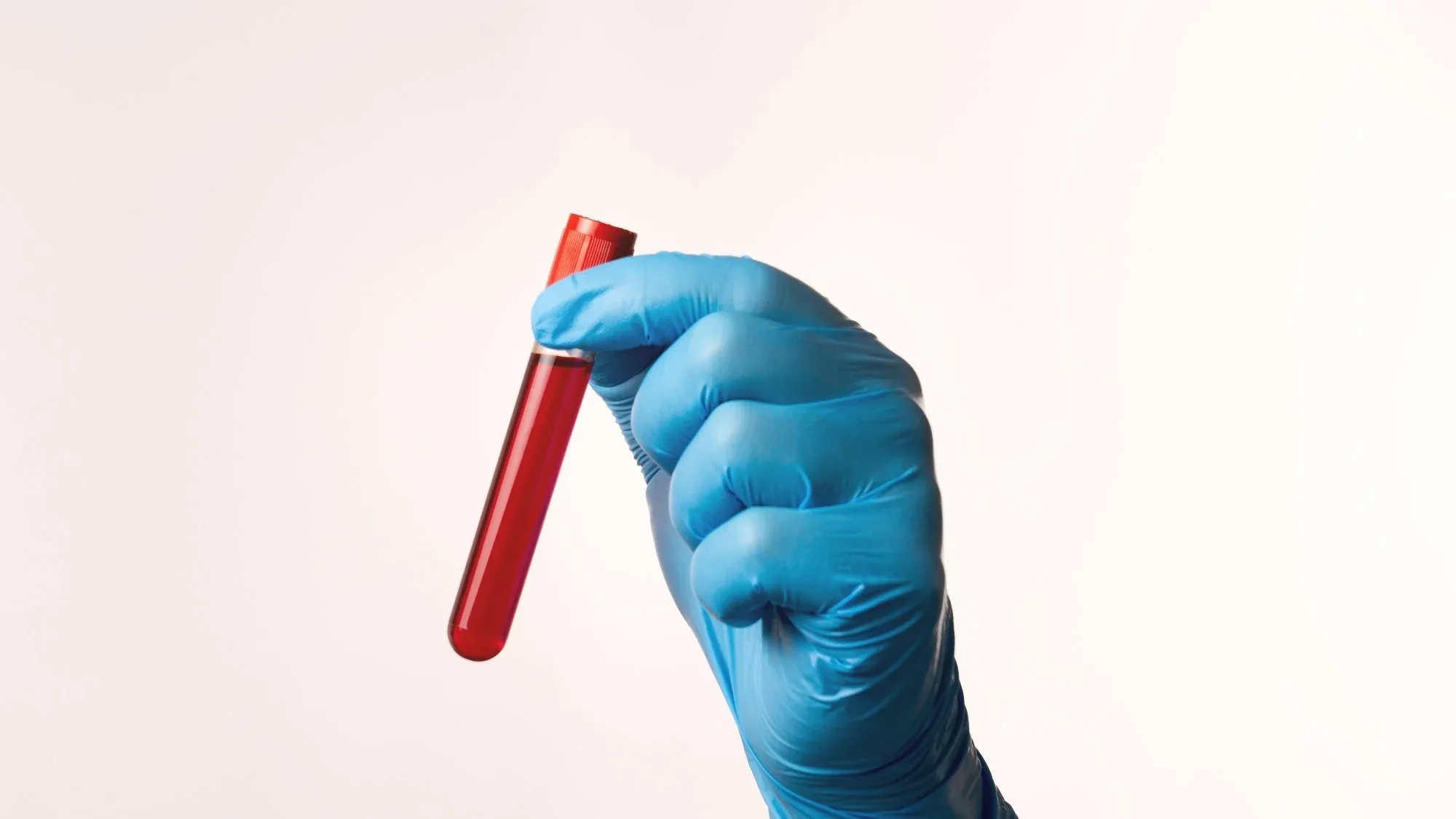 What Can Blood Tests Find and How to Understand Results