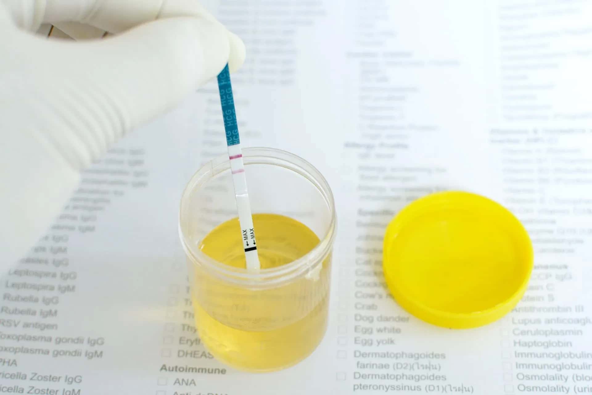 What Is Protein Leakage and What Causes It?