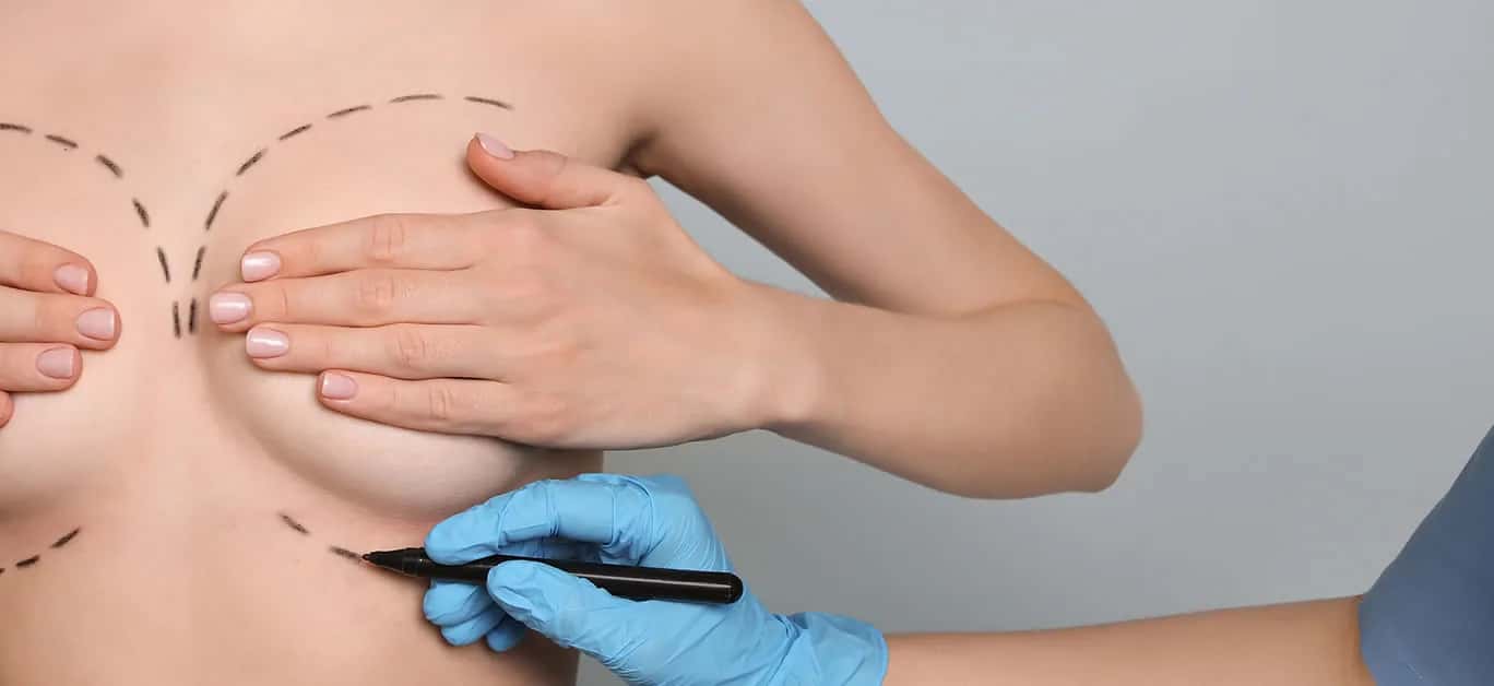 Wie wählen Sie eine Klinik für Brustchirurgie in Brasilien?