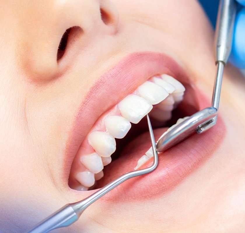 Dental Care