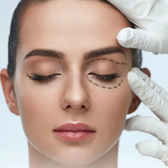Plastic Surgery