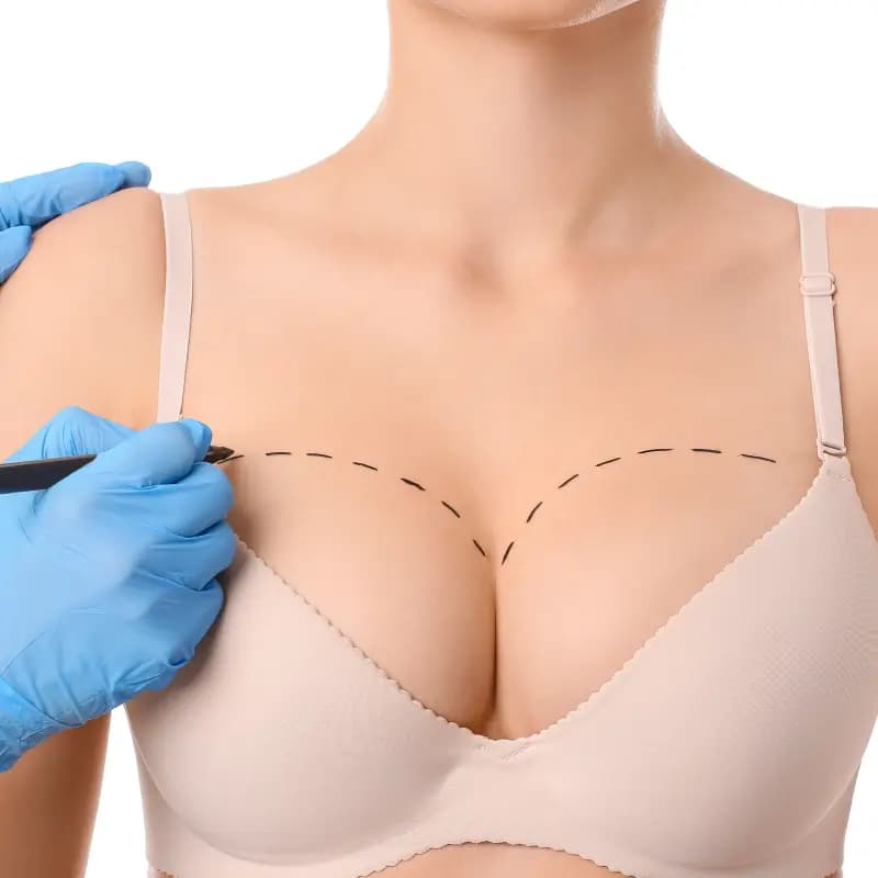 Breast Surgery