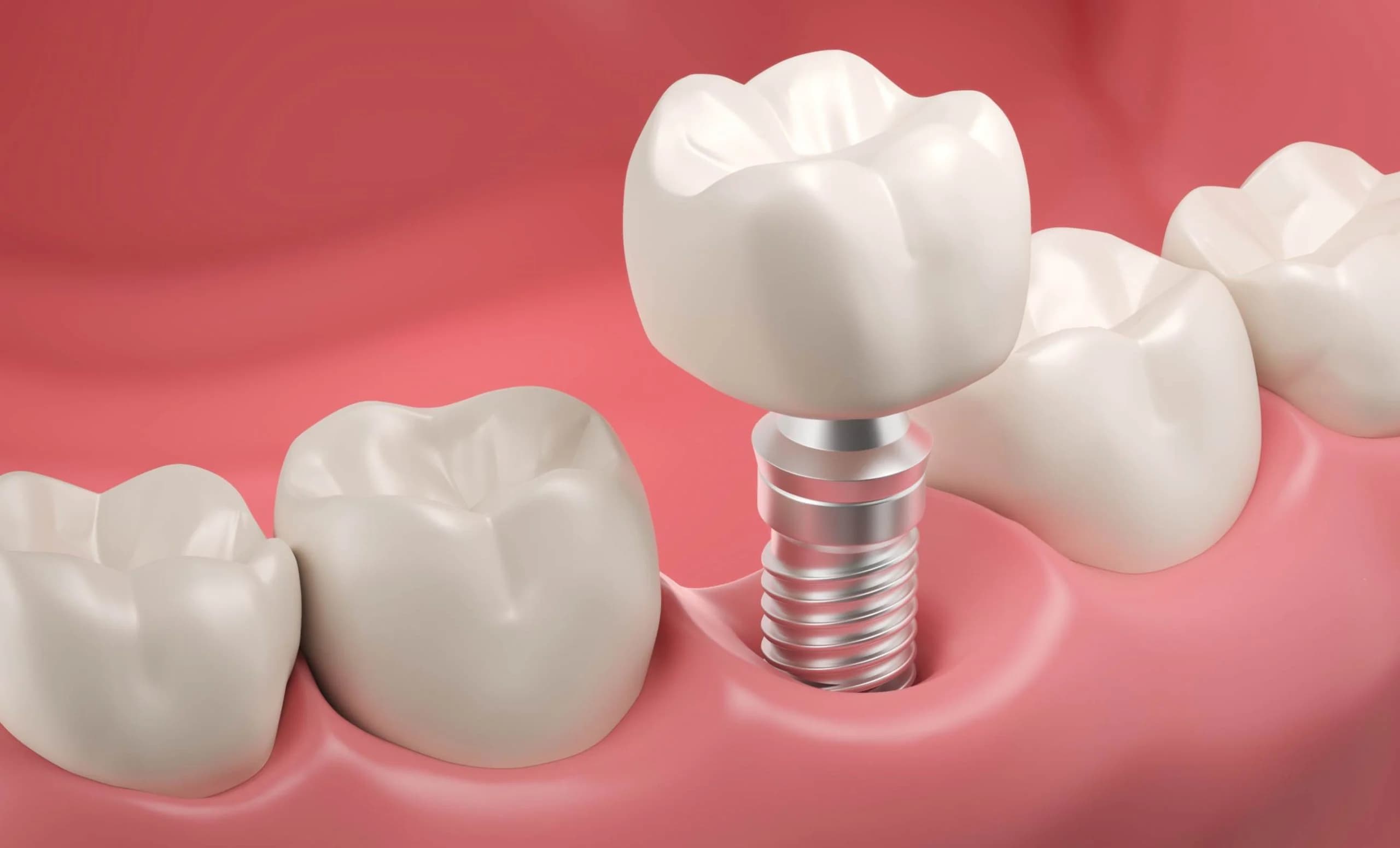 2026 Top 5 Dental Clinics in UK