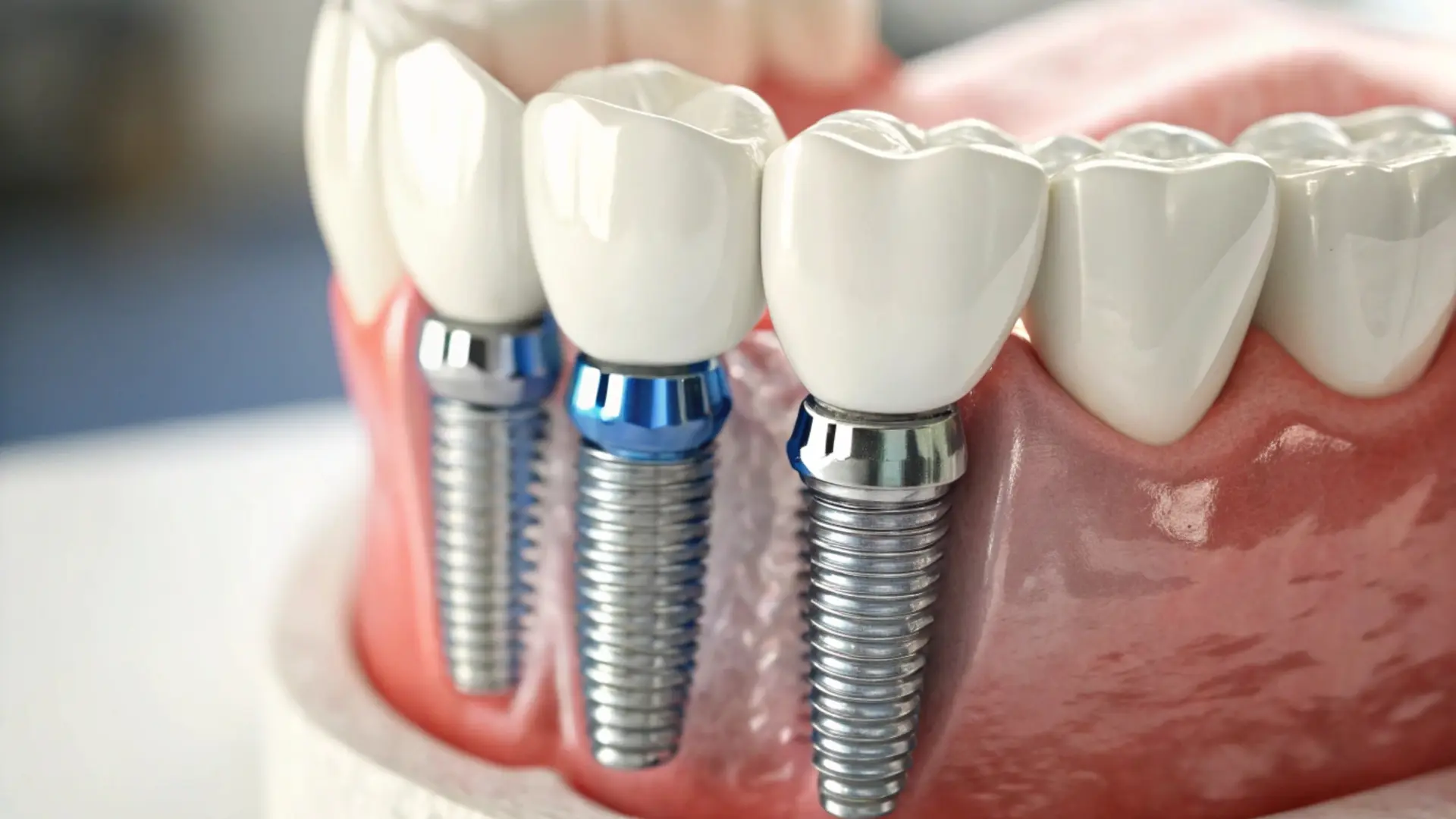 2026 Top 5 Dental Clinics in Thailand