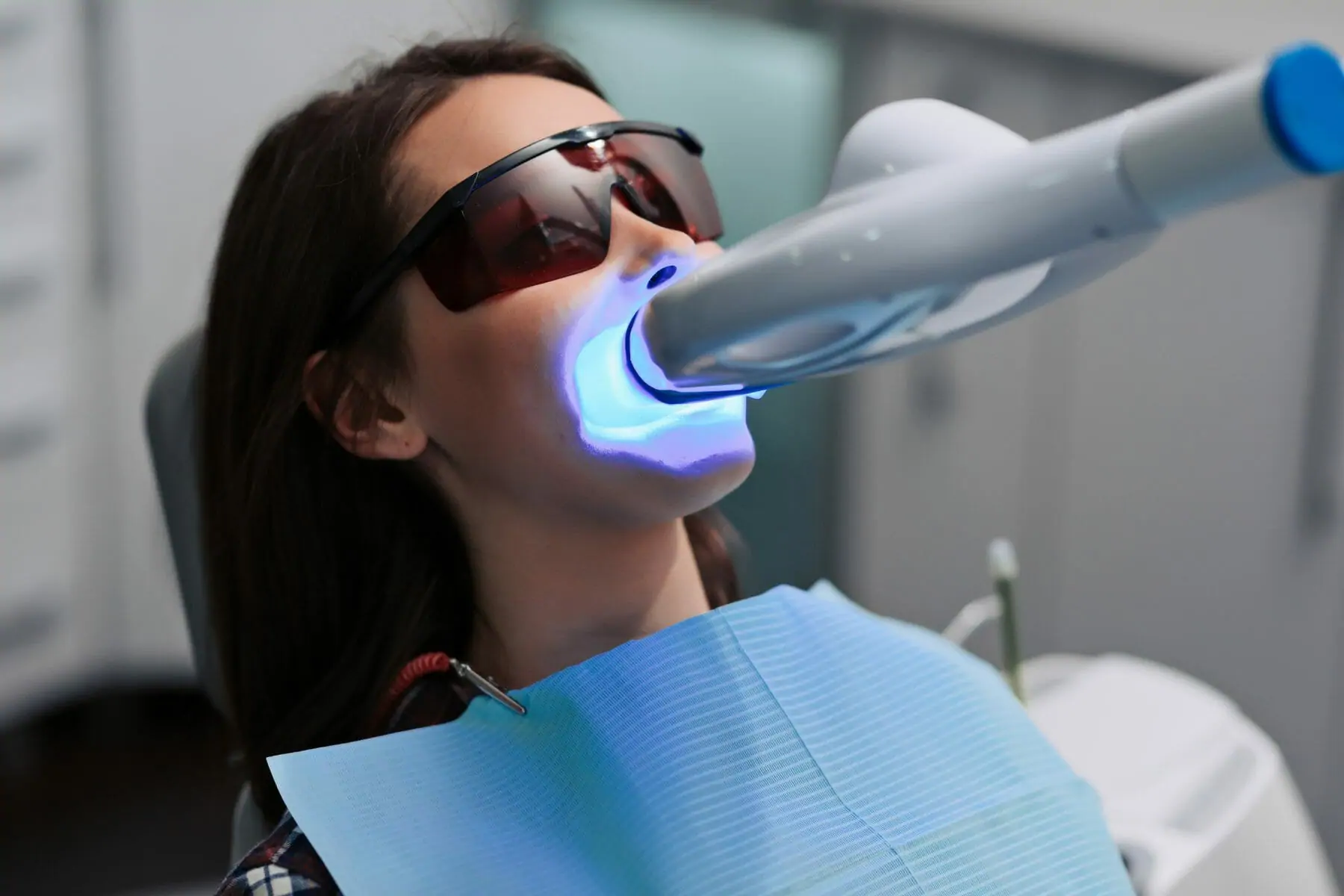 TOP 5 Teeth Whitening (Bleaching) in United States
