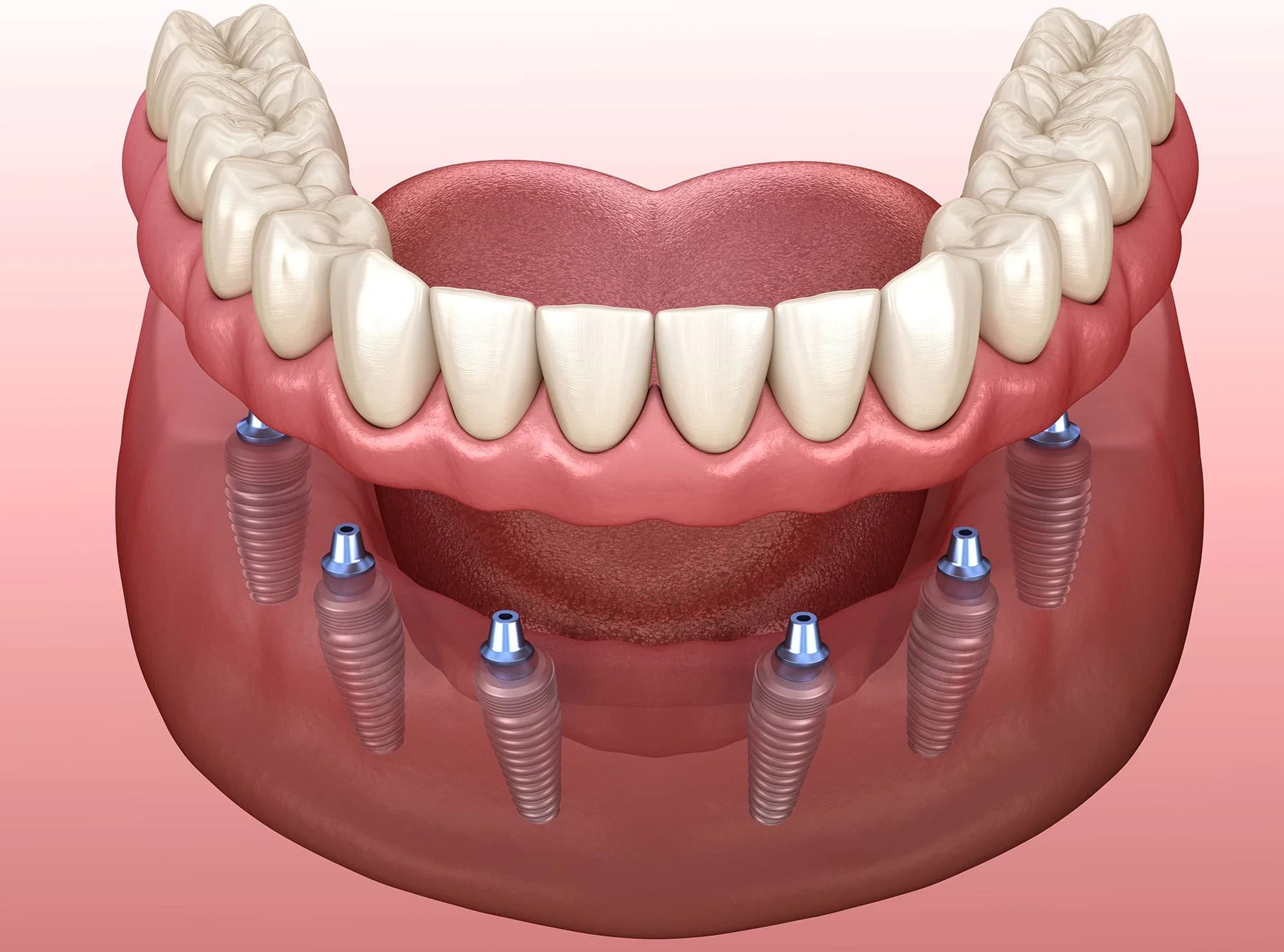 Top 5 Dental Clinics in USA