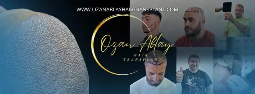 VELUX Hair Transplant