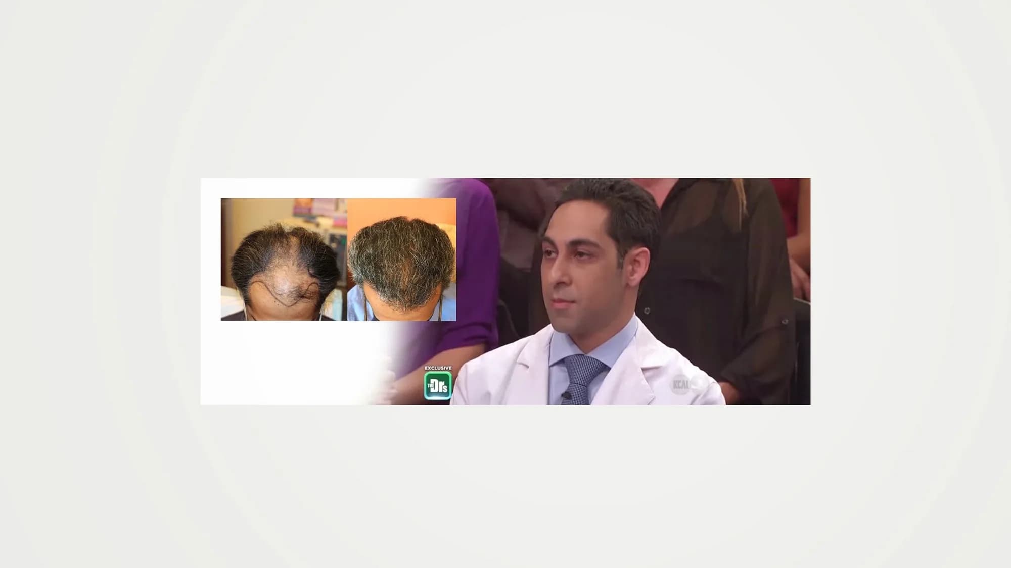Modena Hair Transplant Institute