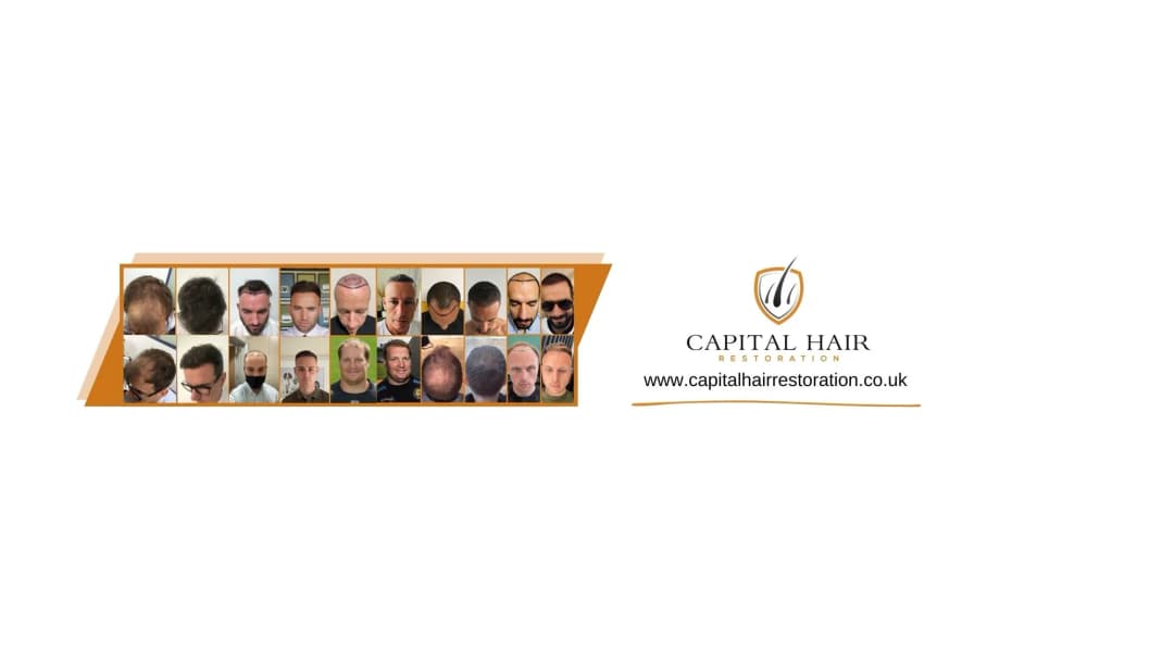 Capital Hair Restoration