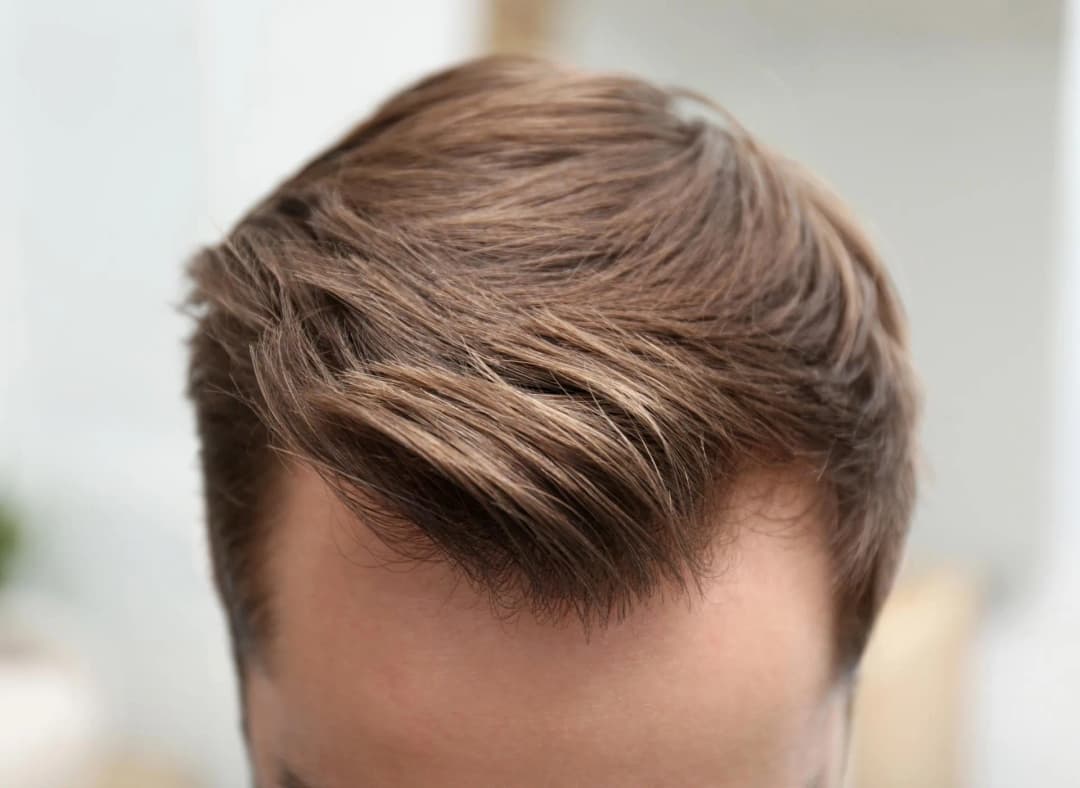 Data Hair Clinic