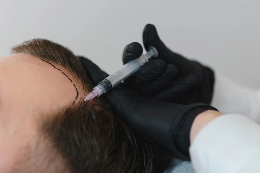 Vital of Hair